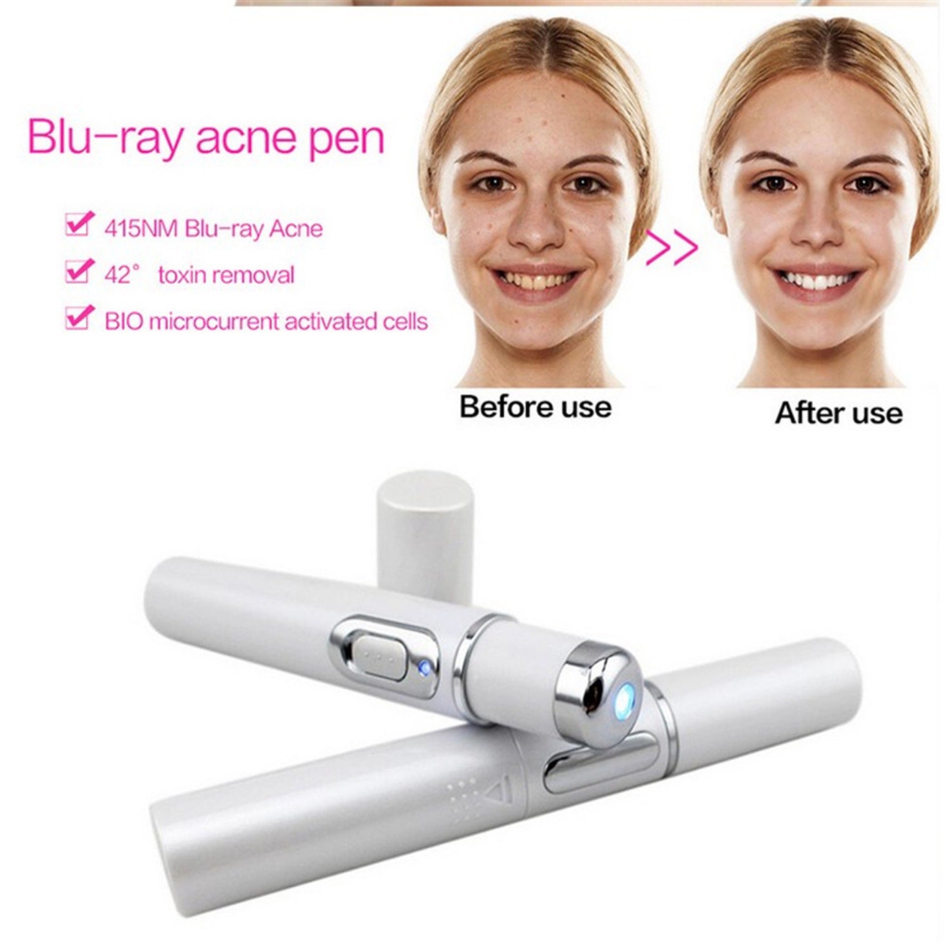 Acne Laser Pen Soft Scar Wrinkle Removal Treatment Device