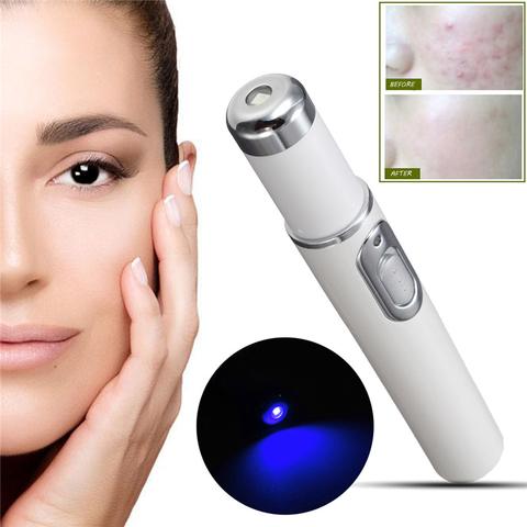 Acne Laser Pen Soft Scar Wrinkle Removal Treatment Device